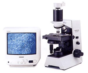 位相差顕微鏡で口腔内の細菌検査